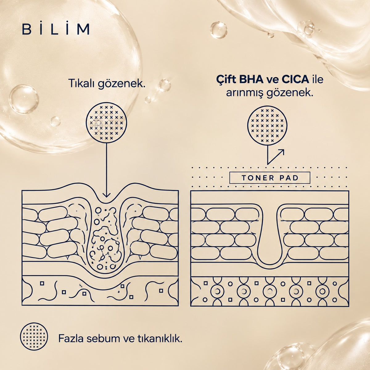 Akne Toner Pad bilim