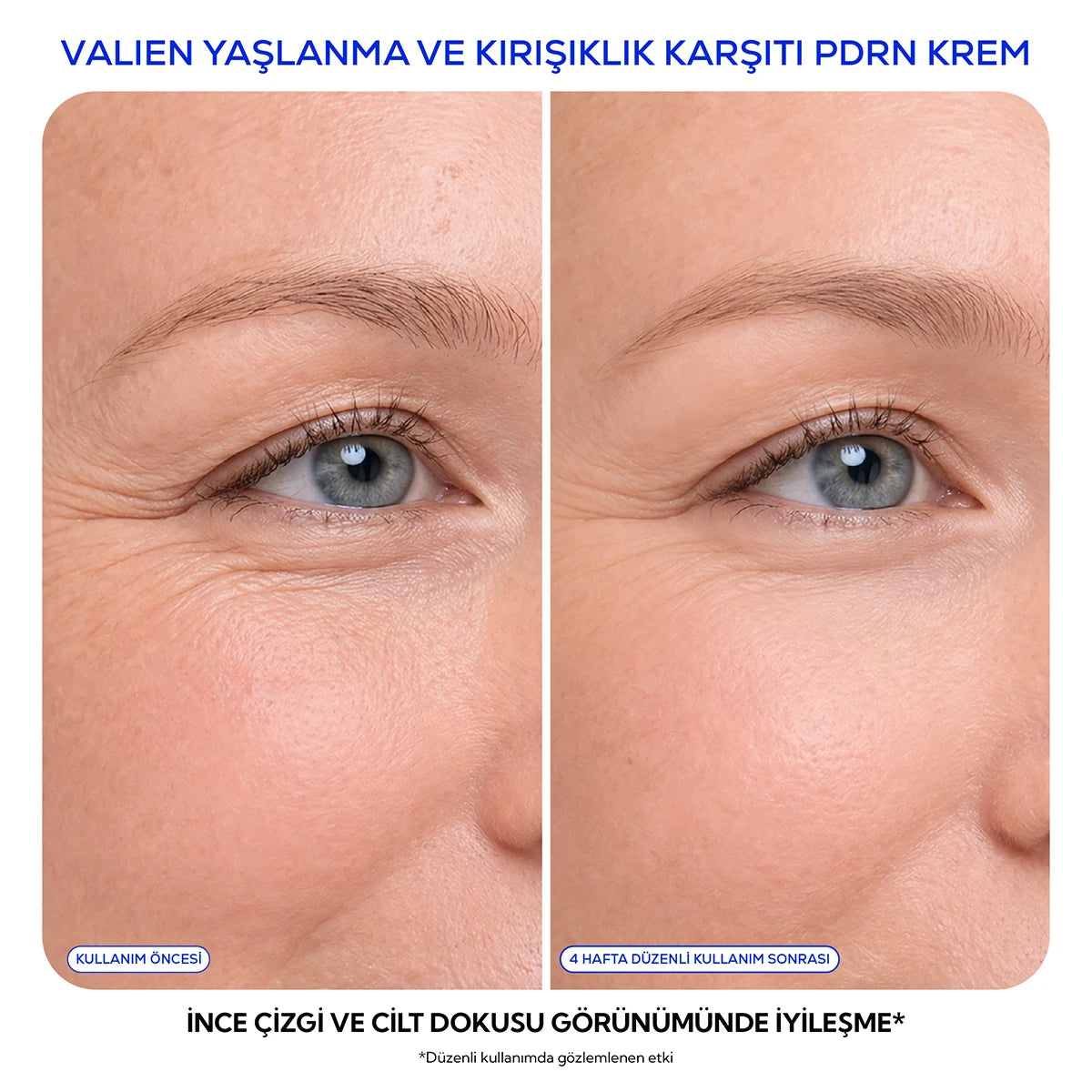 Yaşlanma Karşıtı Krem - (PDRN) Somon DNA (50 ml)