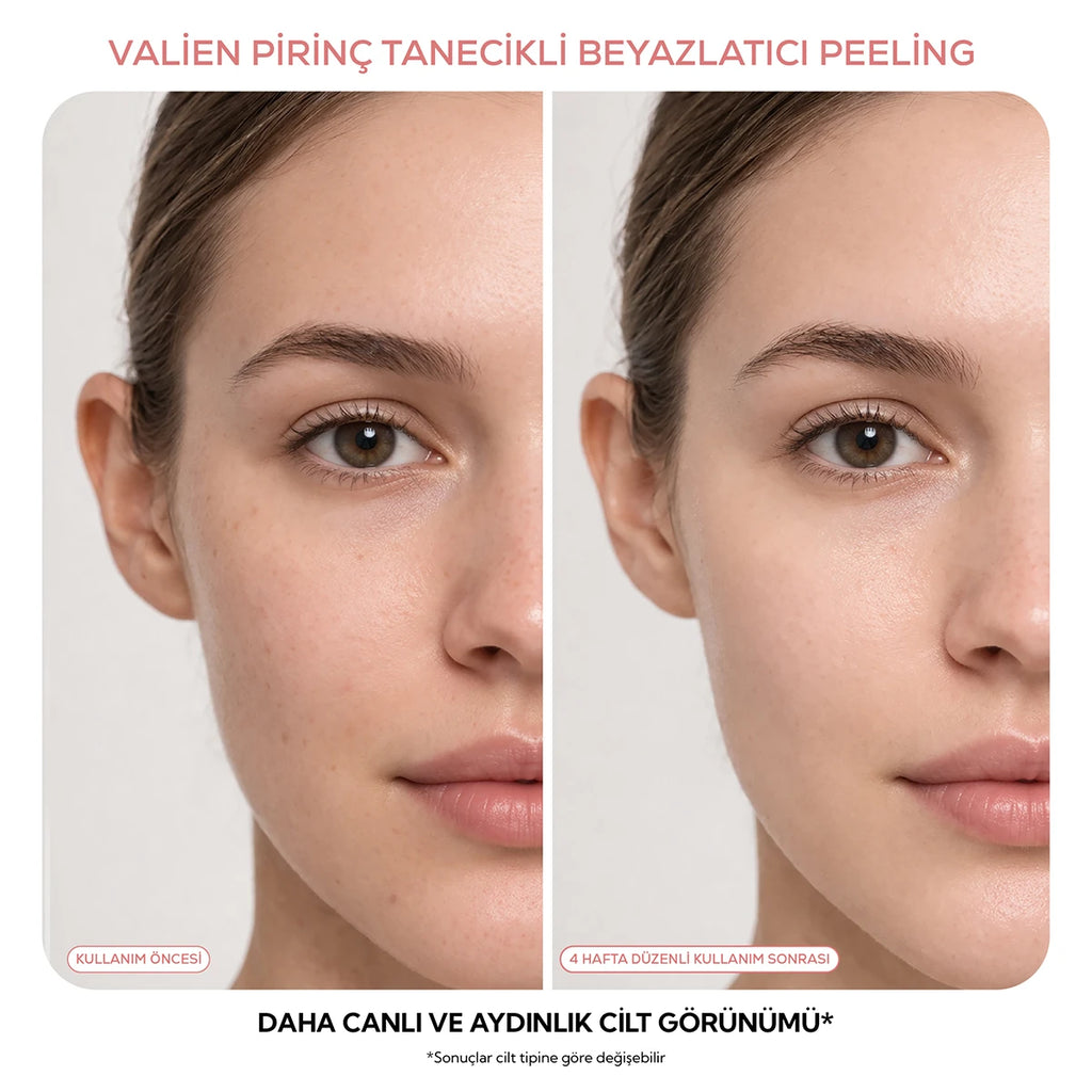 Pirinç Tanecikli Yüz Peelingi - Beyazlatıcı (150 ml)