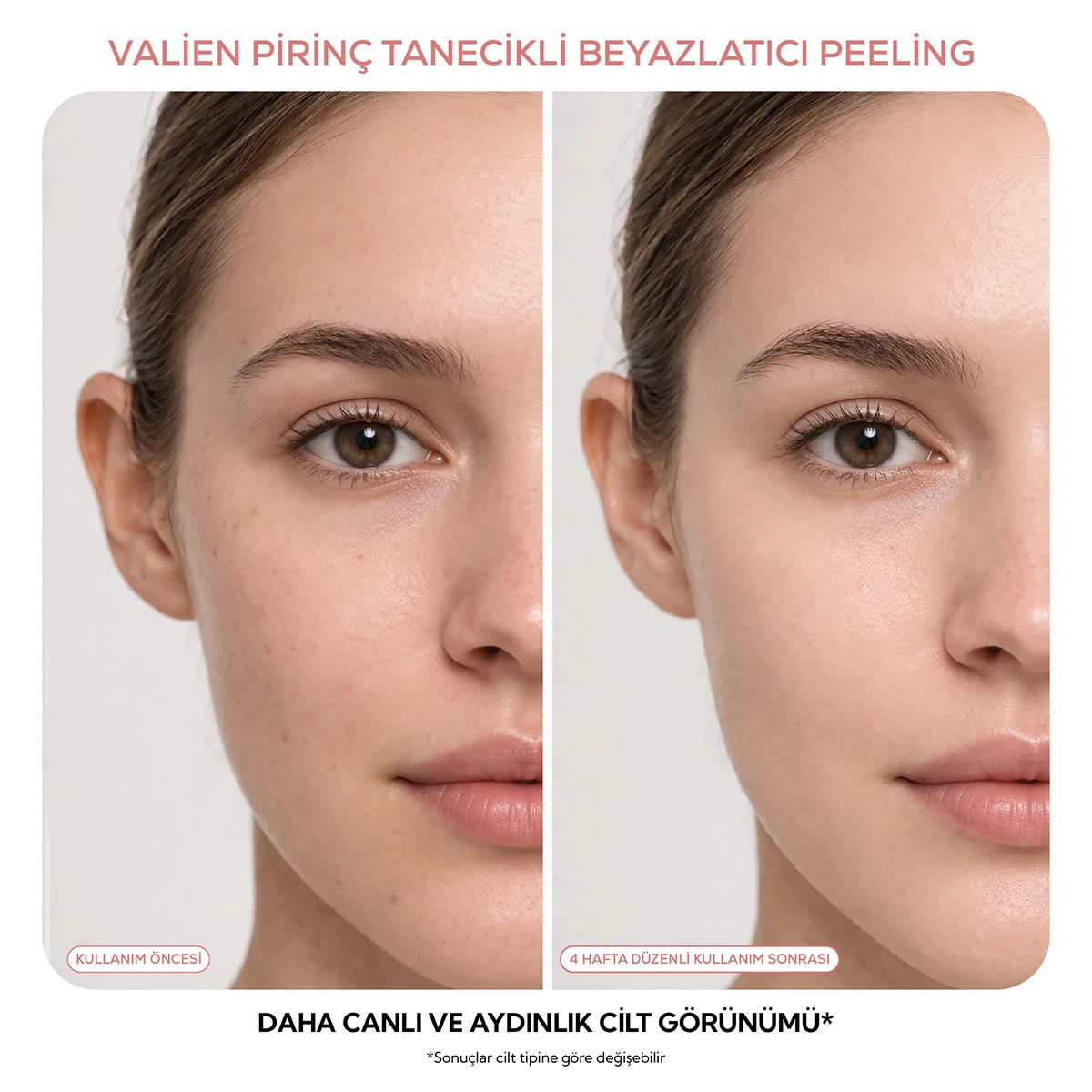 Pirinç Tanecikli Yüz Peelingi - Beyazlatıcı (150 ml)