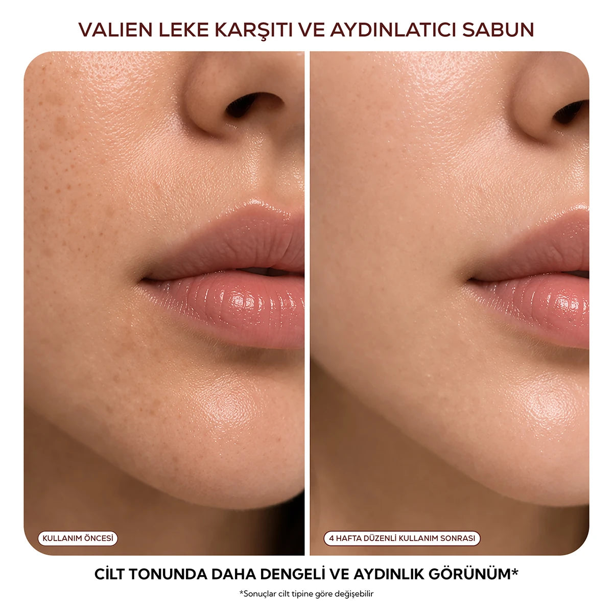 Leke Sabunu -  Leke Karşıtı & Aydınlatıcı (90 gr)