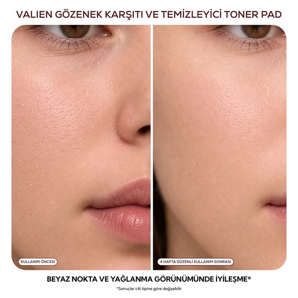 Gözenek Karşıtı & Temizleyici - Toner Pad (60 Adet)