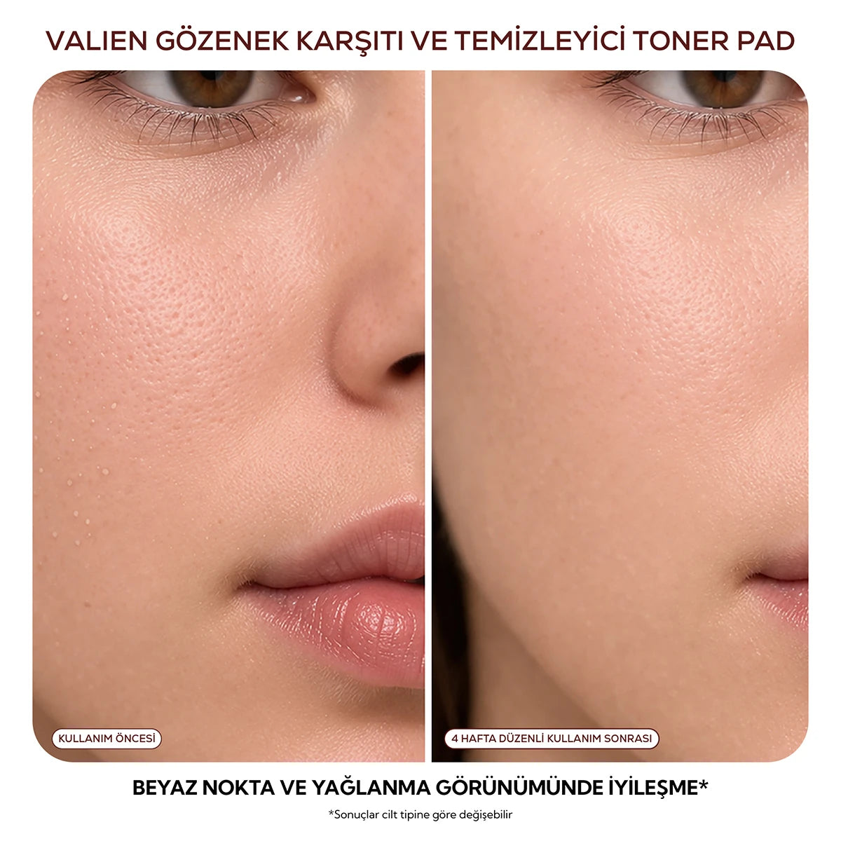 Gözenek Karşıtı & Temizleyici - Toner Pad (60 Adet)