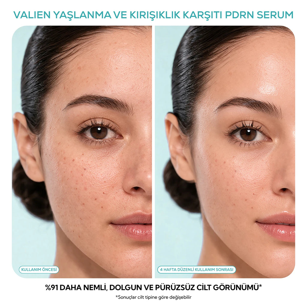 Yaşlanma Karşıtı Serum - (PDRN) Somon DNA (30 ml)