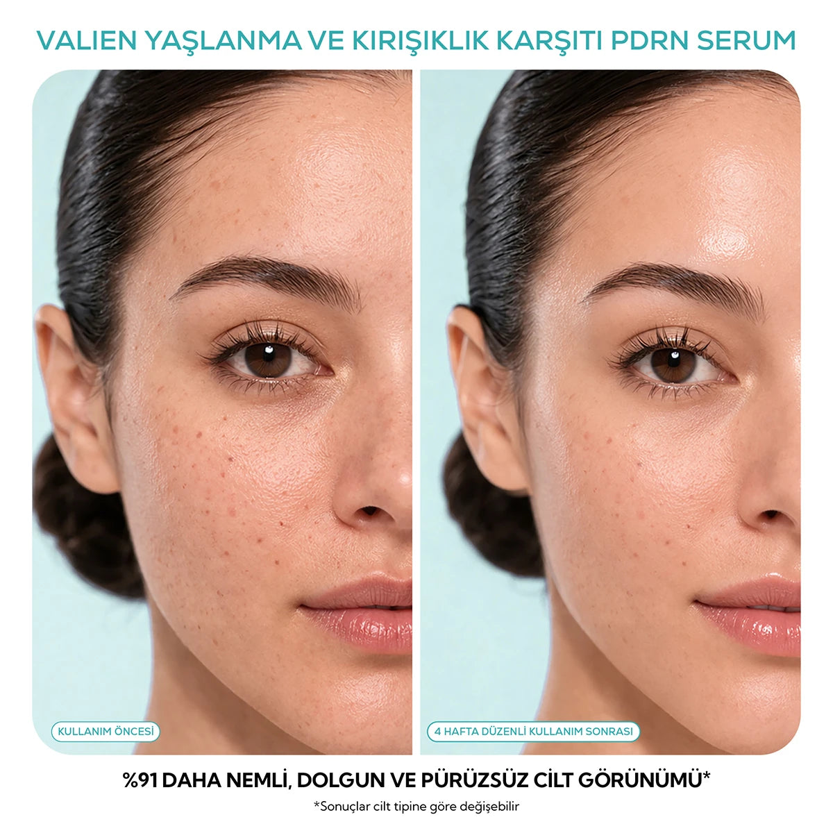 Yaşlanma Karşıtı Serum - (PDRN) Somon DNA (30 ml)