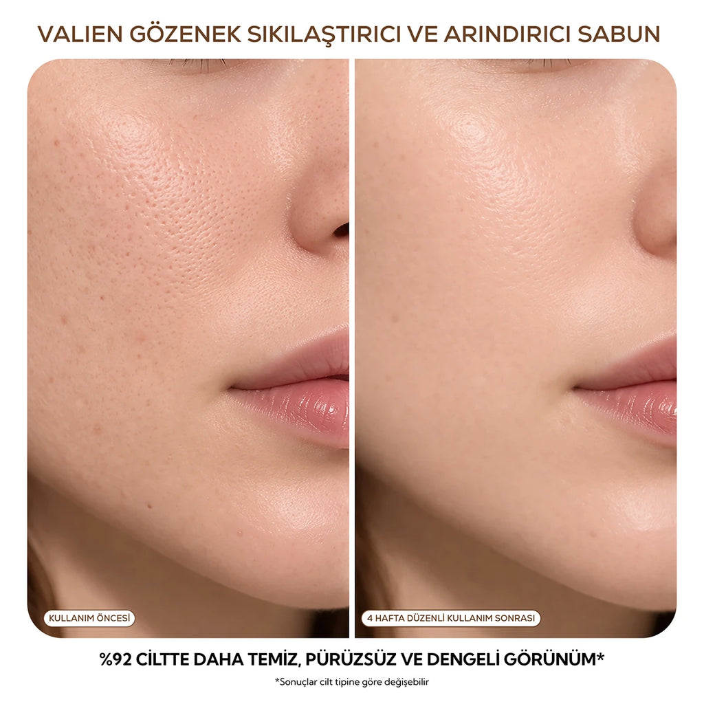 Gözenek Sabunu - Sıkılaştırıcı & Arındırıcı (90 gr)