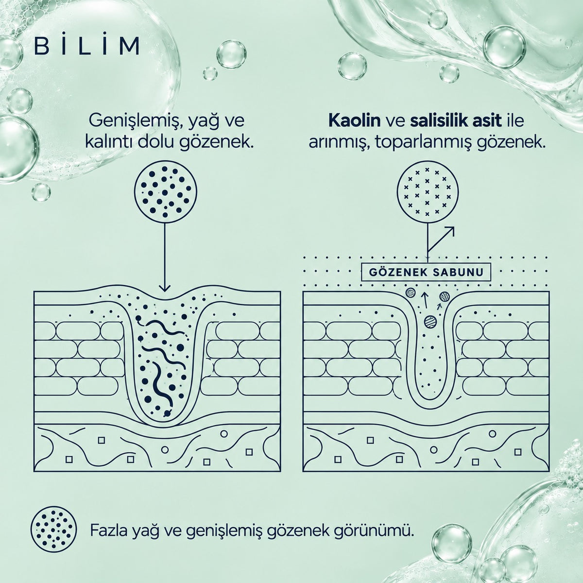 Valien Gözenek Sabunu (90 gr) — cilt yüzeyi çizim diyagramı