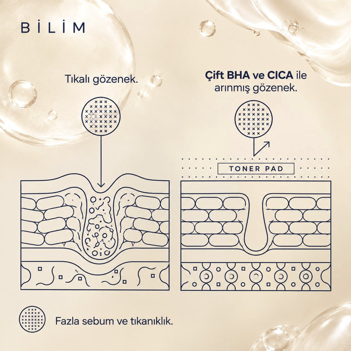 Valien Akne Toner Pad (60 Adet) — cilt yüzeyi çizim diyagramı