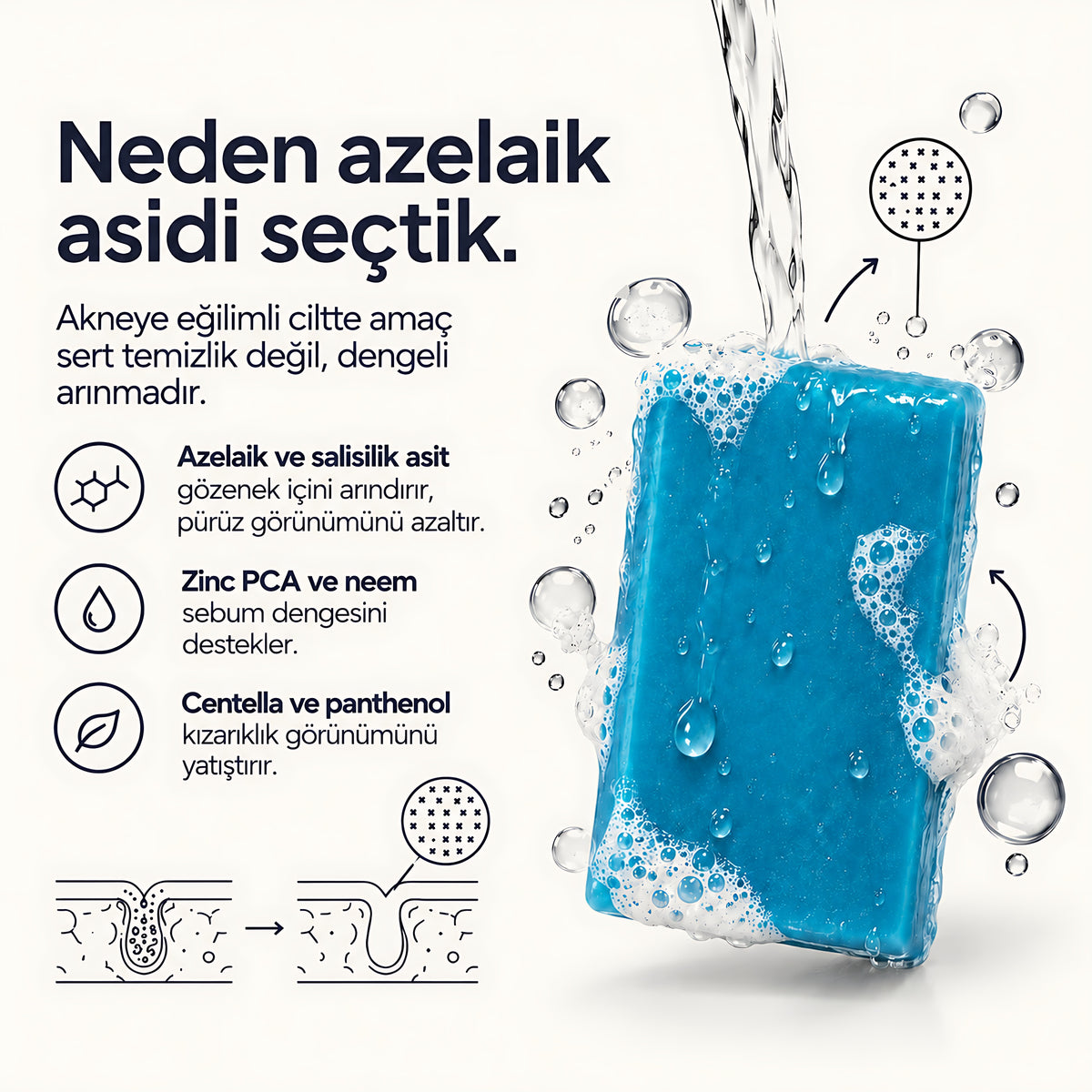 Valien Akne Sabunu (90 gr) — bileşen seçim gerekçesi