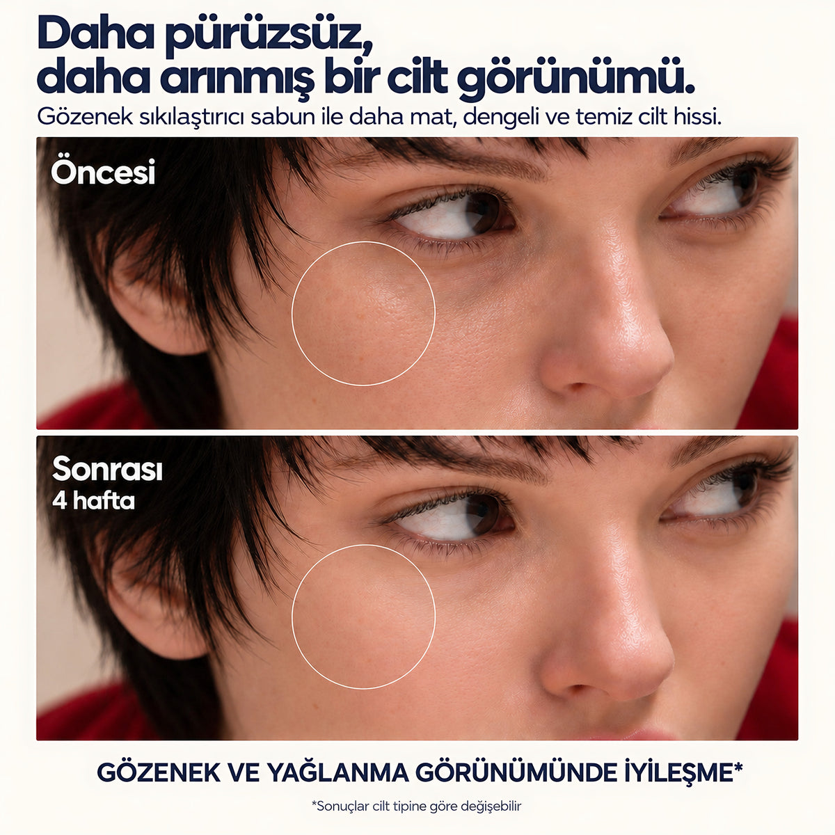 Valien Gözenek Sabunu — öncesi ve sonrası karşılaştırma görseli