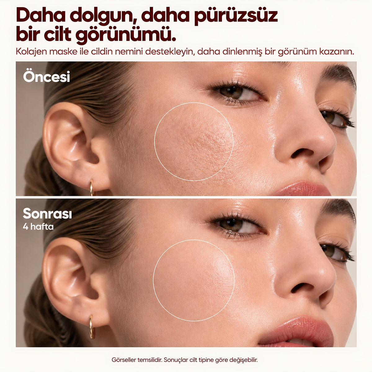 Valien Kolajen Kapsül Maske — öncesi ve sonrası karşılaştırma görseli