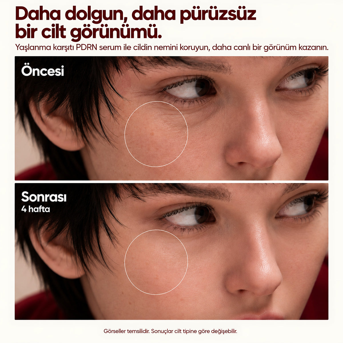 Valien Yaşlanma Karşıtı Serum (PDRN) — öncesi ve sonrası karşılaştırma görseli