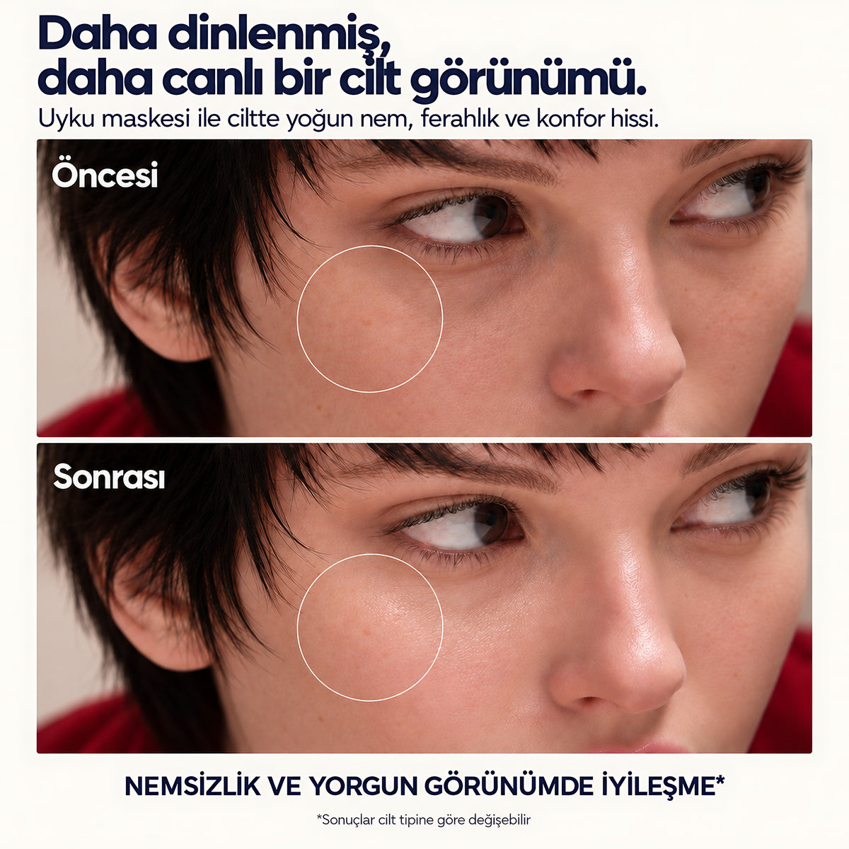 Valien Uyku Maskesi — öncesi ve sonrası karşılaştırma görseli