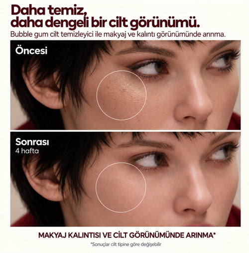 VÀLIEN Bubble Gum Yüz Temizleme Jeli — öncesi ve sonrası karşılaştırma görseli
