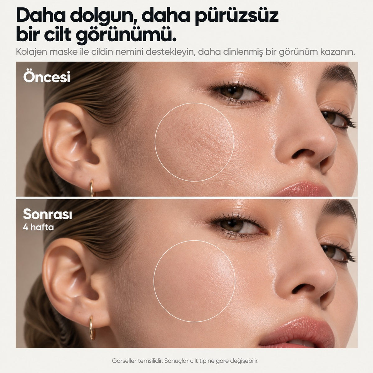 VÀLIEN Kolajen Kapsül Maske — öncesi ve sonrası karşılaştırma görseli